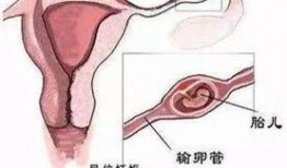 深圳宫外孕爆料新闻,生死时速，守护生命防线